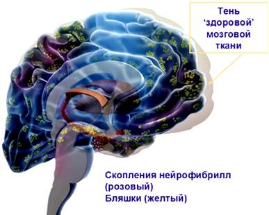 Описание: http://www.alzrus.org/images/books/878/pm/000000016.jpg