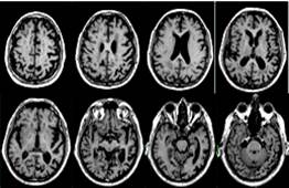Описание: http://www.alzrus.org/images/books/878/pm/000000021.jpg