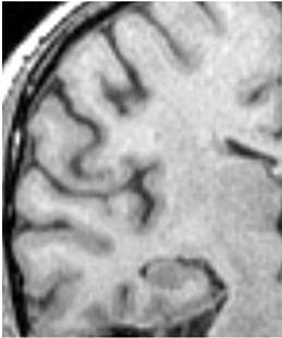 : http://www.alzrus.org/images/books/878/pm/000000018.jpg