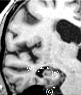 : http://www.alzrus.org/images/books/878/pm/000000019.jpg